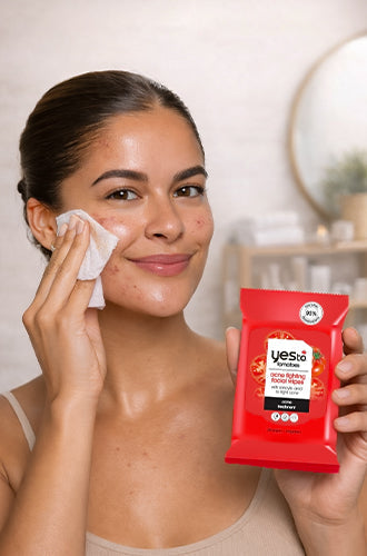 Blemish-Prone skin or Acne